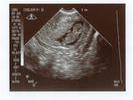 baby9weeks