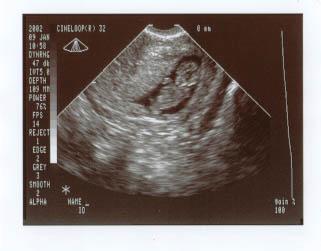 baby9weeks