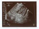 baby9weekshighres