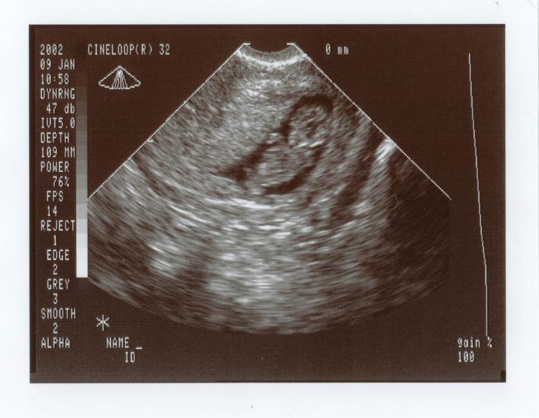 baby9weekshighres