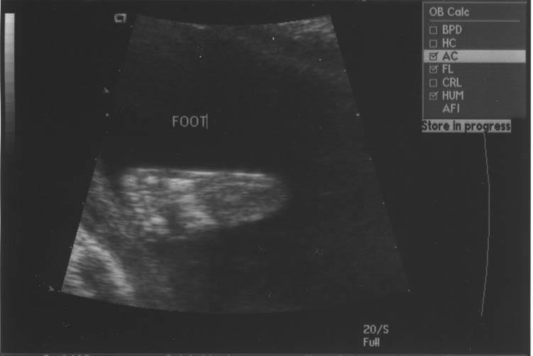 foot